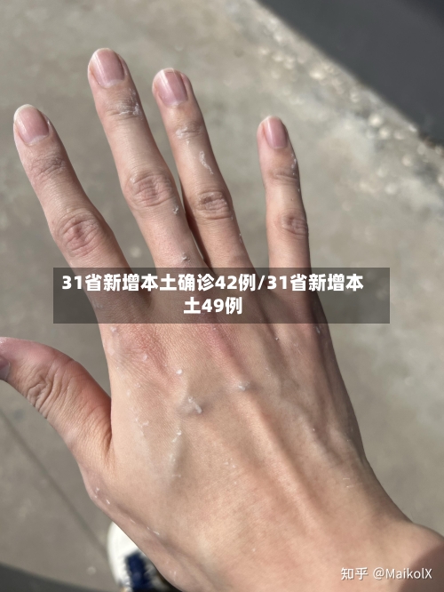 31省新增本土确诊42例/31省新增本土49例-第1张图片