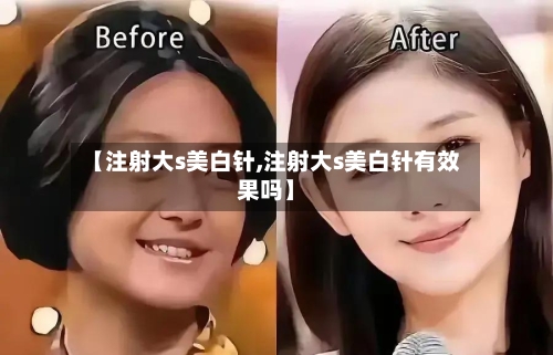 【注射大s美白针,注射大s美白针有效果吗】-第1张图片