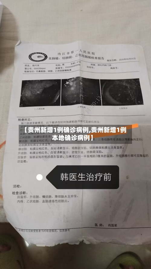 【贵州新增1例确诊病例,贵州新增1例本地确诊病例】-第1张图片